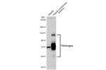 Fibrinogen Antibody in Western Blot (WB)