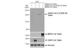 SARS-CoV-2 Spike Protein S2/S2' (strain Wuhan-Hu-1) Antibody in Western Blot (WB)