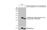 Hepatitis D virus Antibody in Western Blot (WB)