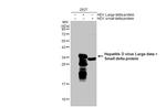 Hepatitis D virus Antibody in Western Blot (WB)