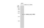 SARS-CoV-2 ORF8 (strain Wuhan-Hu-1) Antibody in Western Blot (WB)