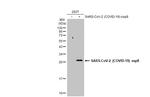 SARS-CoV-2 NSP8 Antibody in Western Blot (WB)