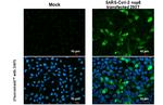 SARS-CoV-2 NSP8 Antibody in Immunocytochemistry (ICC/IF)