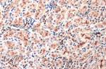 SLC17A3 Antibody in Immunohistochemistry (Paraffin) (IHC (P))