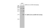 SARS-CoV-2 Envelope Antibody in Western Blot (WB)