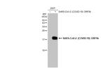 SARS-CoV-2 ORF9b Antibody in Western Blot (WB)