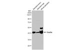 SOX9a Antibody in Western Blot (WB)