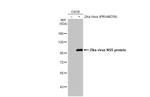 Zika Virus NS5 (strain H/PF/2013) Antibody in Western Blot (WB)