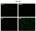 Zika Virus Envelope (strain H/PF/2013) Antibody in Immunocytochemistry (ICC/IF)