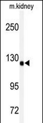 ADAMTS19 Antibody in Western Blot (WB)