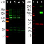 Adenylate Cyclase 3 Antibody in Western Blot (WB)