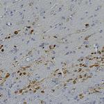 Calretinin Antibody in Immunohistochemistry (Paraffin) (IHC (P))