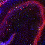 Calretinin Antibody in Immunohistochemistry (PFA fixed) (IHC (PFA))