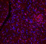 IBA1 Antibody in Immunohistochemistry (Paraffin) (IHC (P))