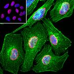 Lamin A/C Antibody in Immunocytochemistry (ICC/IF)