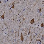 Tau Antibody in Immunohistochemistry (Paraffin) (IHC (P))