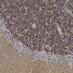 VSNL1 Antibody in Immunohistochemistry (Paraffin) (IHC (P))