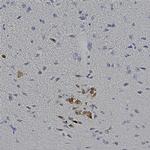 mCherry Antibody in Immunohistochemistry (Paraffin) (IHC (P))