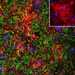 ALDH1L1 Antibody in Immunocytochemistry (ICC/IF)