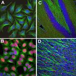 c-Fos Antibody in Immunocytochemistry (ICC/IF)