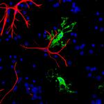 CNPase Antibody in Immunocytochemistry (ICC/IF)