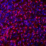 FABP7 Antibody in Immunohistochemistry (IHC)