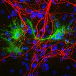 Galectin 3 Antibody in Immunocytochemistry (ICC/IF)