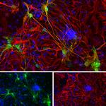 Galectin 3 Antibody in Immunocytochemistry (ICC/IF)