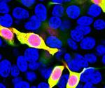 mCherry Antibody in Immunocytochemistry (ICC/IF)