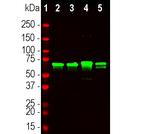 NEFL Antibody in Western Blot (WB)