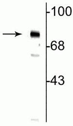 Phospho-MECP2 (Ser80) Antibody in Western Blot (WB)