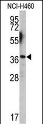 EN2 Antibody in Western Blot (WB)