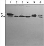 p41-ARCb Antibody in Western Blot (WB)