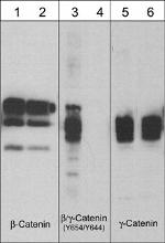 Phospho-beta Catenin/gamma Catenin (Tyr654, Tyr644) Antibody in Western Blot (WB)