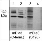 Phospho-DIAPH2 (Ser196) Antibody in Western Blot (WB)