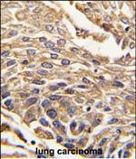 Arylsulfatase B Antibody in Immunohistochemistry (Paraffin) (IHC (P))