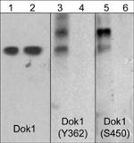 Phospho-DOK1 (Ser450) Antibody in Western Blot (WB)