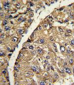 Vitronectin Antibody in Immunohistochemistry (Paraffin) (IHC (P))