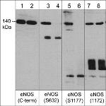 Phospho-eNOS (Ser1177) Antibody in Western Blot (WB)