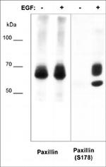 Phospho-Paxillin (Ser178) Antibody in Western Blot (WB)