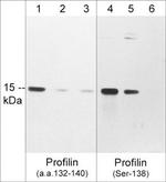 Phospho-Profilin 1 (Ser138) Antibody in Western Blot (WB)