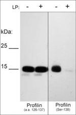 Phospho-Profilin 1 (Ser138) Antibody in Western Blot (WB)