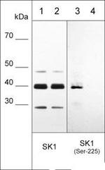 Phospho-SPHK1 (Ser225) Antibody in Western Blot (WB)