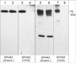 SPHK2 Antibody in Western Blot (WB)