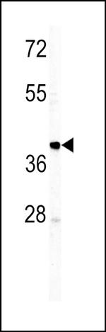 Human IgM Secondary Antibody in Western Blot (WB)