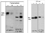 VEGF Receptor 2 Antibody in Western Blot (WB)