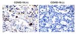 SARS 3CL Protease Antibody in Immunohistochemistry (Paraffin) (IHC (P))