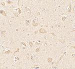 LC3B Antibody in Immunohistochemistry (Paraffin) (IHC (P))