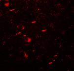 LC3B Antibody in Immunohistochemistry (Paraffin) (IHC (P))