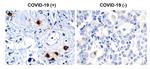 SARS-CoV-2 NSP7 Antibody in Immunohistochemistry (Paraffin) (IHC (P))